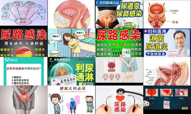 汕头尿道炎膀胱炎症状图片