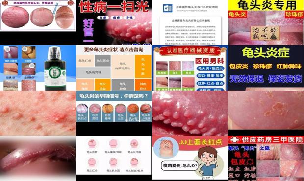 汕头念珠性龟炎症状