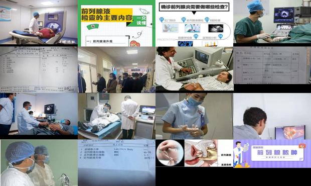 汕头前列腺检查