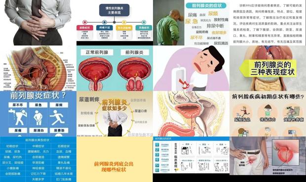 汕头前列腺有哪些症状表现