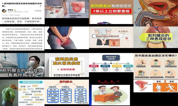 汕头前列腺炎症状是什么表现