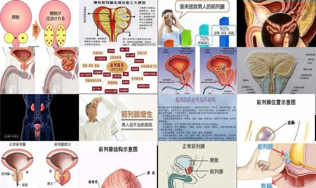 汕头前列腺是怎么引起的