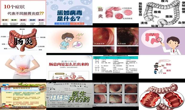 汕头肠炎症状