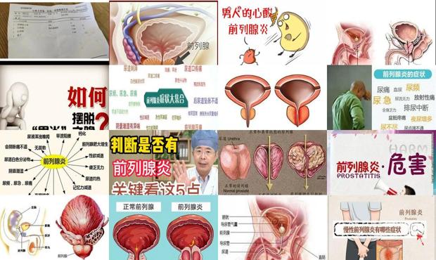 汕头前列腺炎是什么