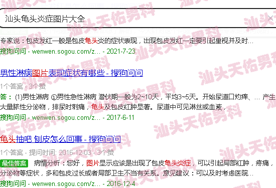 汕头龟头炎症图片大*