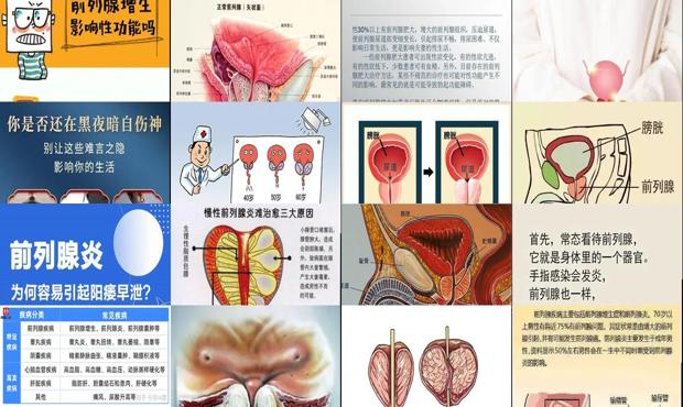 汕头前列腺影响性功能吗