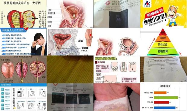 汕头前列腺炎早射
