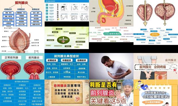 汕头为什么会前列腺炎症状