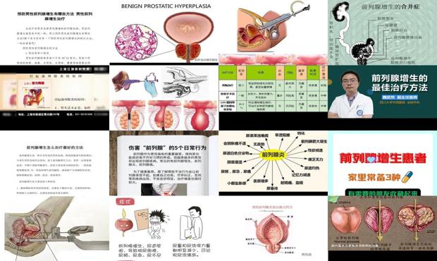 汕头前列腺增生的治疗方法