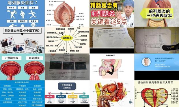 汕头前泪腺炎症状