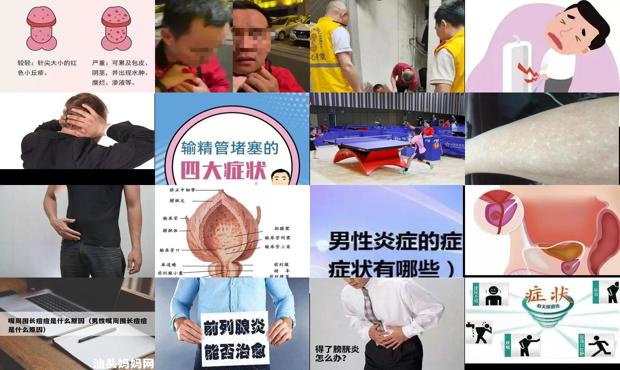 汕头男性炎症症状表现