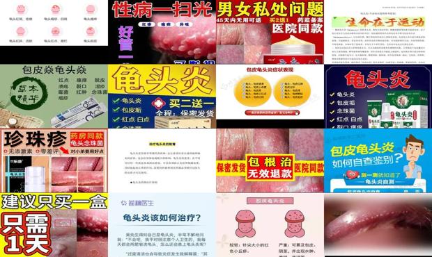 汕头龟头炎症怎么治