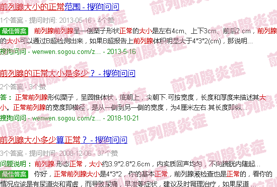 汕头前列腺大小的正常标准是多少