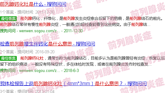 汕头前列腺钙化灶是啥意思