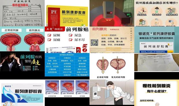 汕头慢性前列腺炎症状治疗