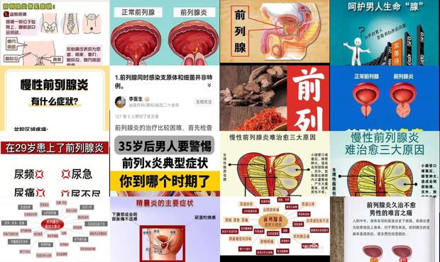 汕头前列腺炎 症状