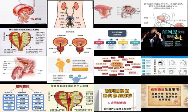 汕头前列腺炎症状及危害