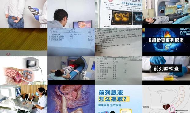 汕头检查前列腺怎么检查