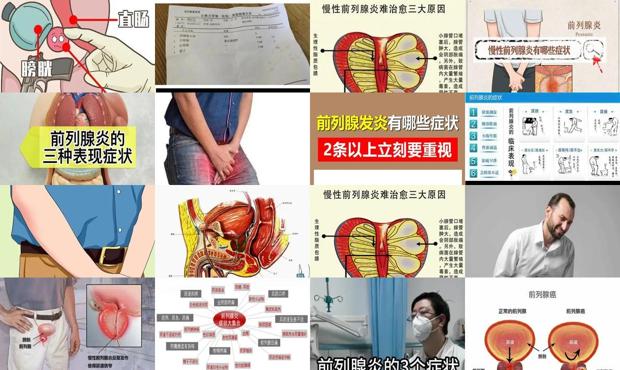 汕头关于前列腺炎症状照片