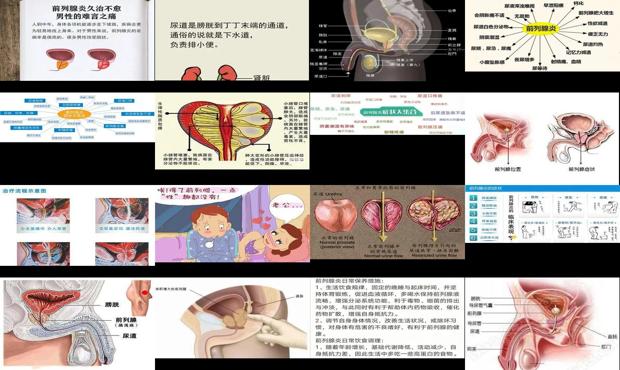汕头前列腺炎的由来
