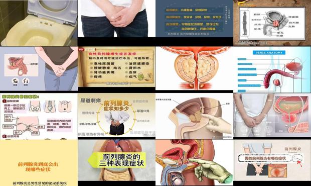 汕头得了前列腺是什么症状