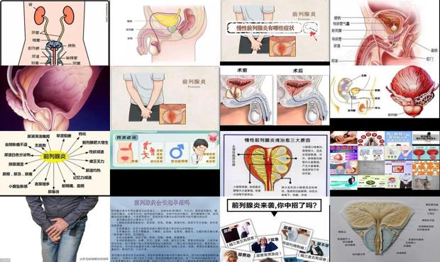 汕头前列腺炎是什么原因引起