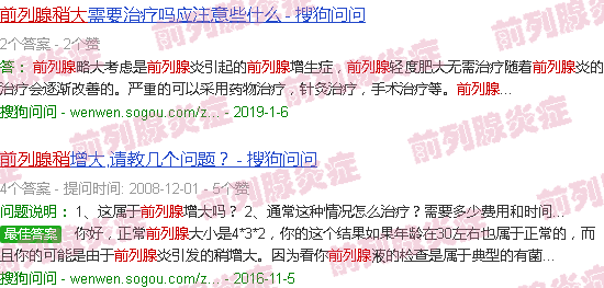 汕头前列腺稍大
