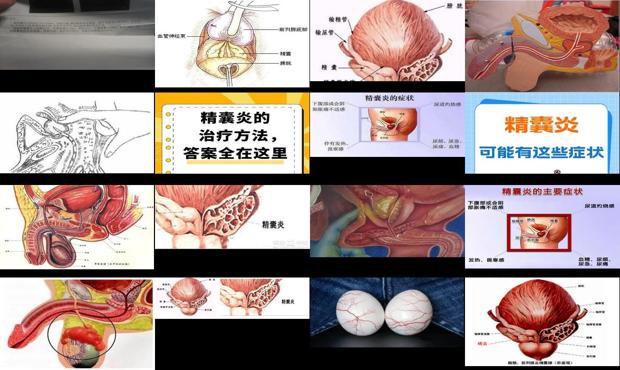 汕头精襄炎症状