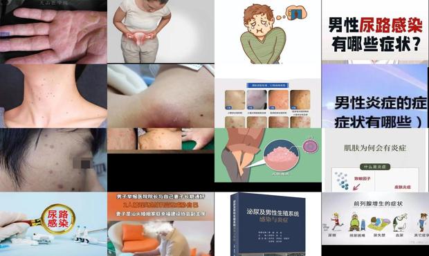 汕头男性被感染了炎症有什么症状
