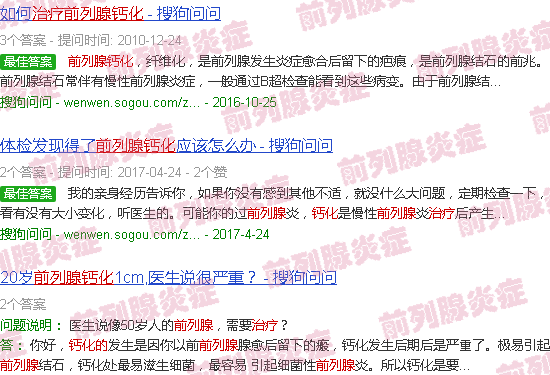 汕头前列腺钙化的治疗