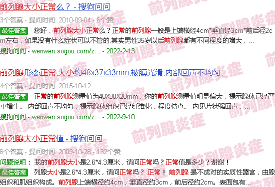 汕头前列腺正常尺寸多大