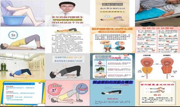 汕头前列腺增生的锻炼方法