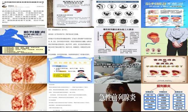 汕头前列腺炎什么症状有哪些症状