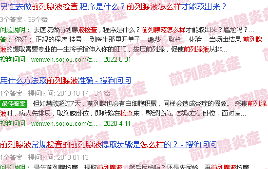 汕头前列腺液怎么检查的