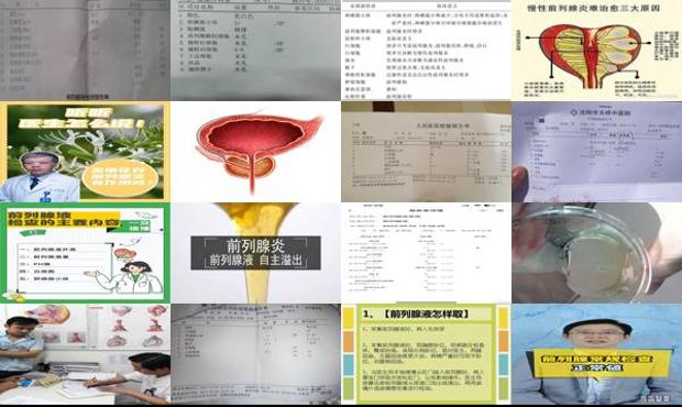 汕头前列腺液怎么检查的